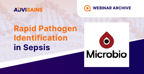 Webinar: The Future of Rapid Pathogen Identification in Sepsis